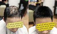重慶各類無(wú)痕接發(fā)定制