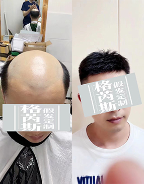各類無(wú)痕接發(fā)定制