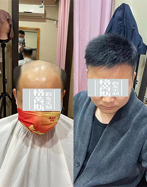 制作好后，根據(jù)您的頭型量身剪裁，設(shè)計(jì)您喜歡的發(fā)型