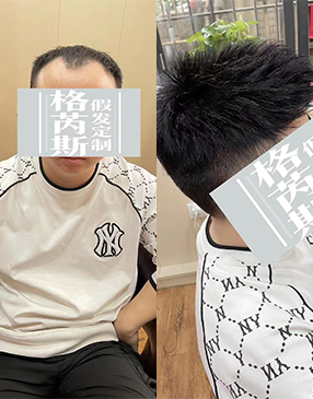 各類無(wú)痕接發(fā)定制