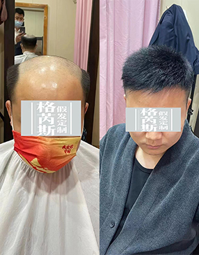 各類無(wú)痕接發(fā)定制