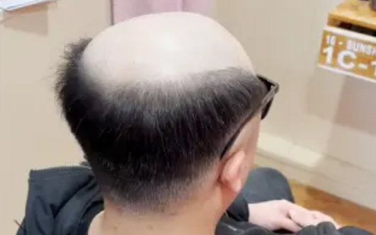 因?yàn)槎d頂小胖哥的直觀年齡看起來(lái)比實(shí)際年齡大許多