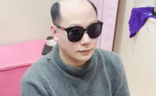 定制假發(fā)的意義在于符合自己的審美、穿搭、年齡